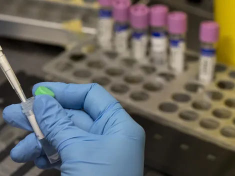 ¿Dónde son más baratos los exámenes de laboratorio en Santiago?