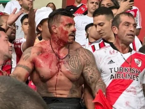 Sangrienta pelea entre hinchas de River y policía de Perú