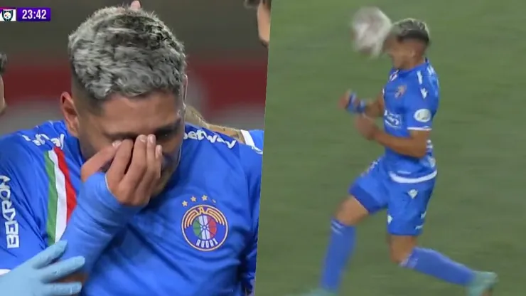 Luis Riveros sufrió un trauma ocular