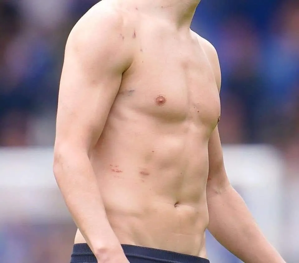 Así quedó el cuerpo de Haaland tras los arañazos