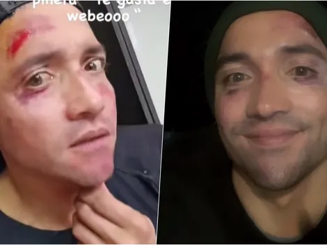 El pelotazo que noqueó a Miguel Pinto: "Perdí el conocimiento"