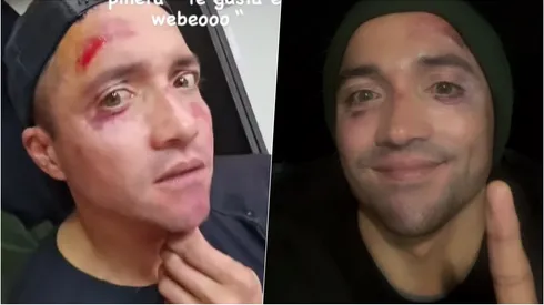 Un balón complicó a Miguel Pinto