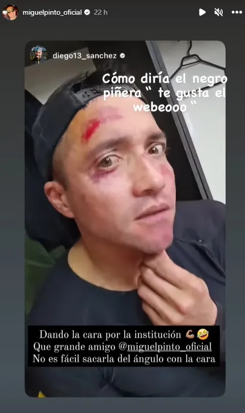 Así quedó Miguel Pinto | Instagram