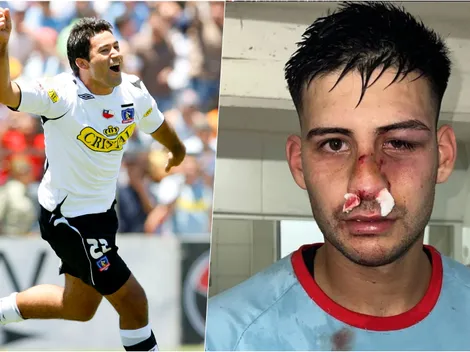 Ex Colo Colo le rompe todo lo que se llama cara a rival