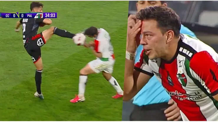 Meza recibió una fuerte patada de Jeyson Rojas.