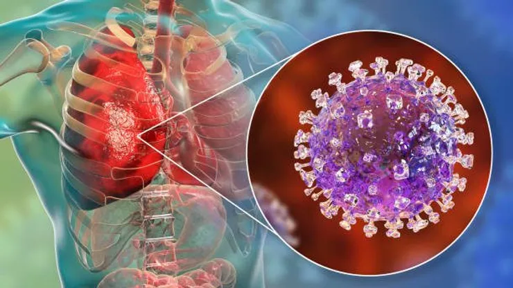 Virus Nipah