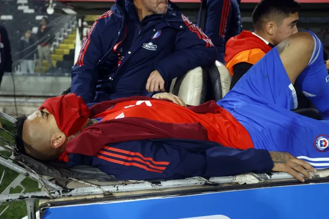 Así salió Arturo Vidal de la cancha del estadio Monumental. (Andrés Piña/Photosport).