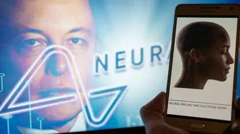 ¡Como en Black Mirror! Elon Musk lanza novedoso chip cerebral.