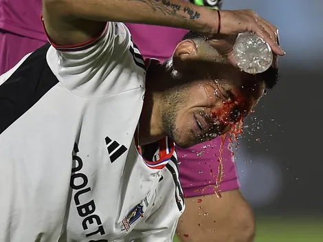 Ramiro calma a los hinchas tras su aterrador corte en la frente