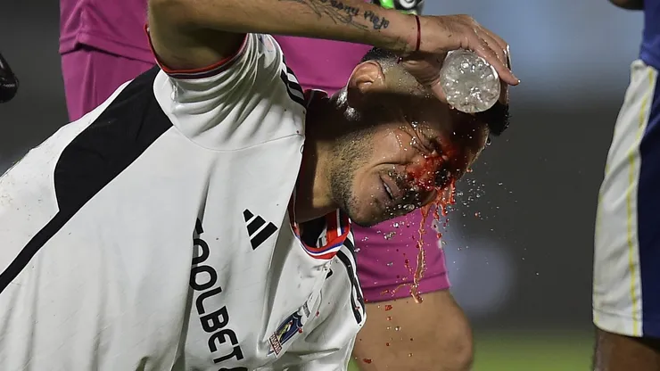 Ramiro González ingresó y duró sólo unos minutos en la cancha tras sufrir un feo corte en su frente.