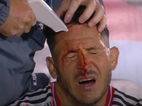 Estreno amargo: la dolorosa imagen de Ramiro González