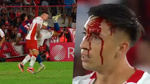 Echeverría sufrió un duro golpe en el clásico ante San Lorenzo.