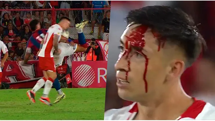 Echeverría sufrió un duro golpe en el clásico ante San Lorenzo.