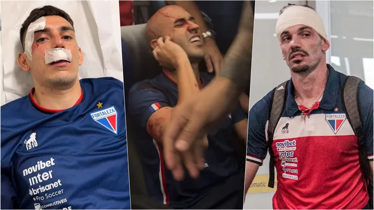 Los jugadores de Fortaleza terminaron en el hospital tras la brutal agresión a su bus.