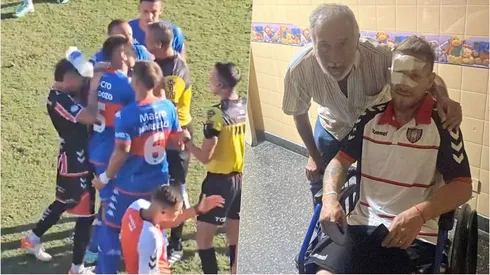 Un jugador de Chacarita recibió un botellazo en el rostro