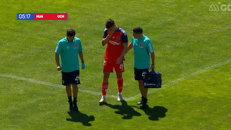 Juan Pablo Gómez salió lesionado del amistoso entre la U y Huachipato.