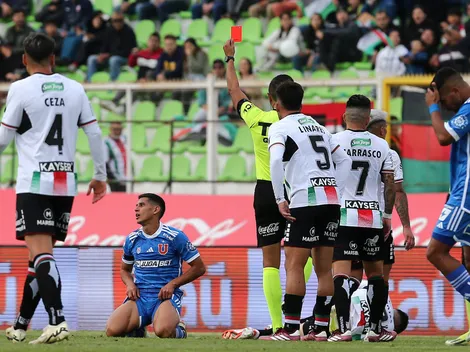 Las dolorosas bajas que tiene la U ante Huachipato