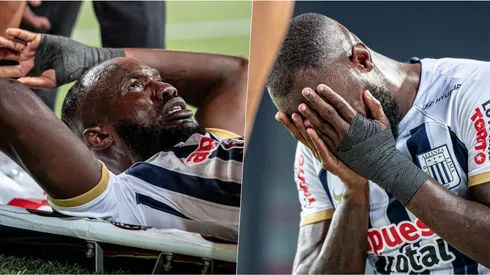 El panameño anotó, pero salió lesionado en Perú.