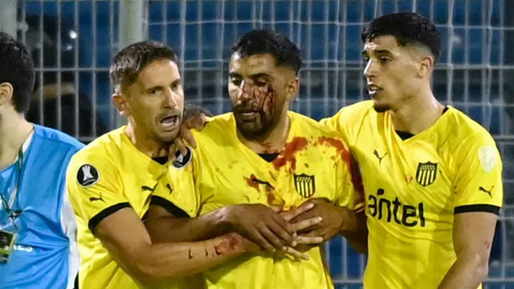 Maximiliano Olivera de Peñarol recibe proyectil en el rostro en el duelo contra Rosario Central.