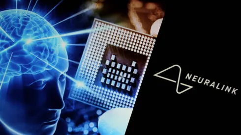 Falla primer implante de chip cerebral de Elon Musk