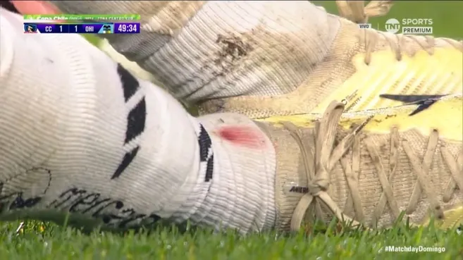 Así quedó la pierna de Carlos Palacios.  (Captura TNT Sports).