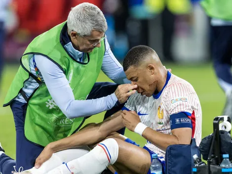 Peor que Rocky: la impactante imagen de Mbappé