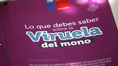 Viruela del mono