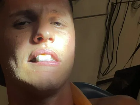 Ex Colo Colo manda al rival a un dentista de madrugada