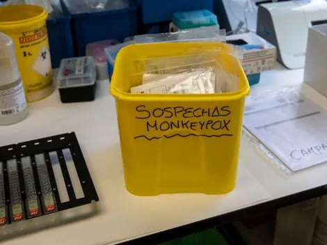 Descubren viruela del mono que "fulminante"