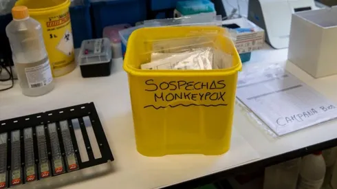 Descubren viruela del mono que "fulminante"