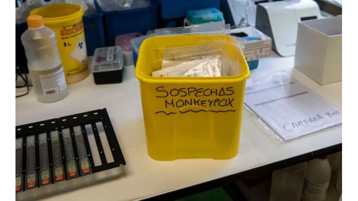 Descubren viruela del mono que "fulminante"