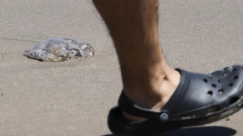 ¿Qué hacer si te pica la fragata portuguesa?