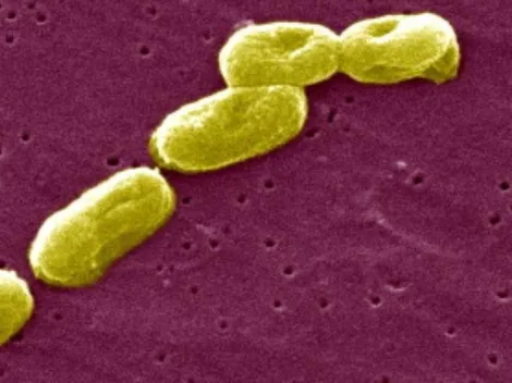 ¿Qué es la Burkholderia cepacia que ha dejado 35 personas fallecidas en Chile?