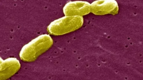 ¿Qué es la Burkholderia cepacia que ha dejado 35 personas fallecidas en Chile?