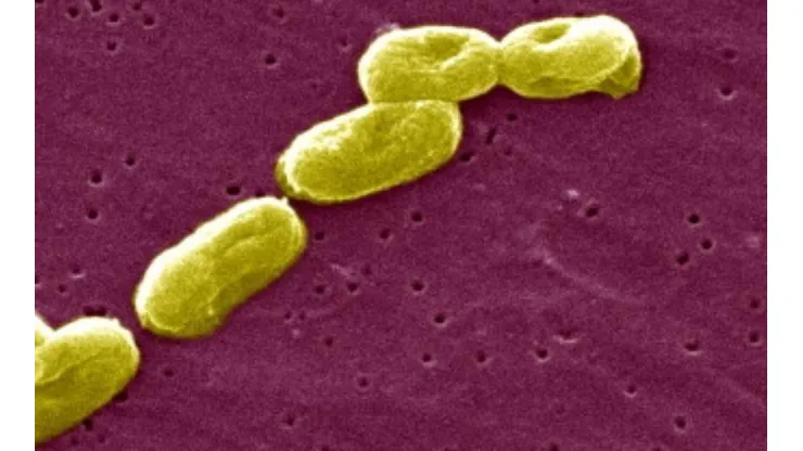 ¿Qué es la Burkholderia cepacia que ha dejado 35 personas fallecidas en Chile?