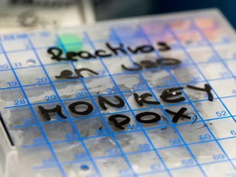 Enfermedades que dejarán de ser emergencia en 2023