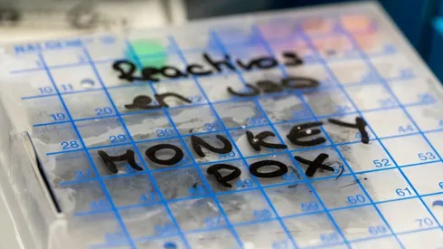 Enfermedades que dejarán de ser emergencia en 2023