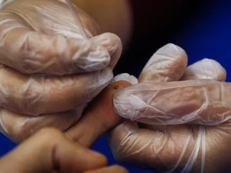 Vacuna experimental contra el VIH muestra prometedores resultados