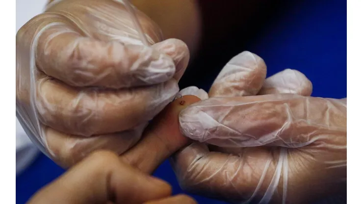 Vacuna experimental contra el VIH muestra prometedores resultados