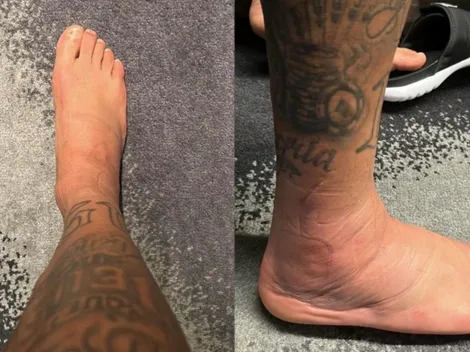 Neymar muestra que tiene el tobillo como empanada