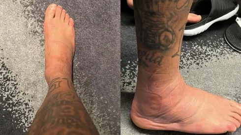 La figura de Brasil muestra su grave lesión en el tobillo derecho.