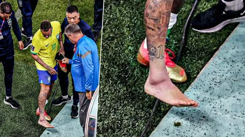 El tobillo hinchado de Neymar: esguince por trauma directo.