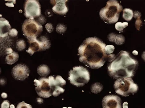 ¿Qué es la Candida Auris y por qué es tan peligroso?