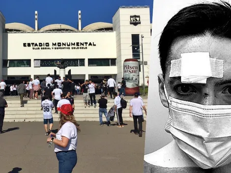 Periodista de TVN denuncia agresión de barristas de Colo Colo