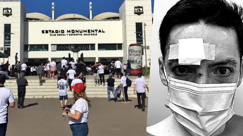 El periodista Rodrigo Arellano mostró las consecuencias del ataque que sufrió en el estadio Monumental