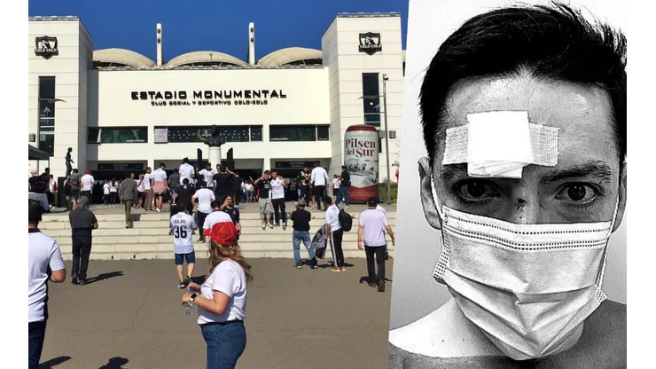 El periodista Rodrigo Arellano mostró las consecuencias del ataque que sufrió en el estadio Monumental