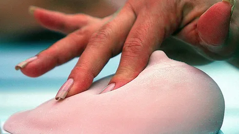 Empresa internacional dona 1.500 mamografías