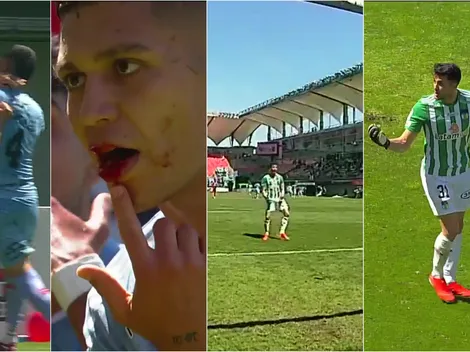 Un codazo y un "Pato Yáñez" desatan un escándalo en Chillán