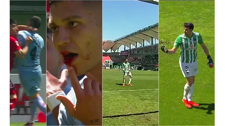 Diego González y Alexis Martín Arias, dos nombres claves en el caldeado final del duelo entre Ñublense y O'Higgins.