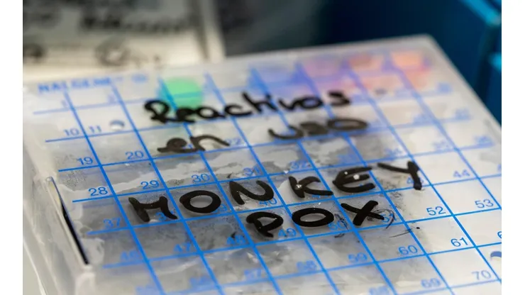 ¿Cuáles son los síntomas más comunes de la Viruela del Mono y cómo se contagia?